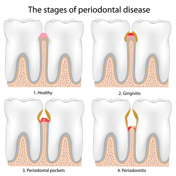Parodontologia